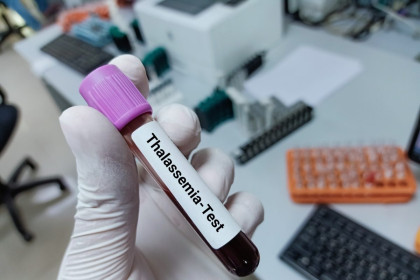 Experts urge awareness to reduce the rising thalassaemia cases