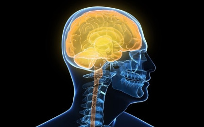 Brain training cuts dementia risk by 25% in landmark study