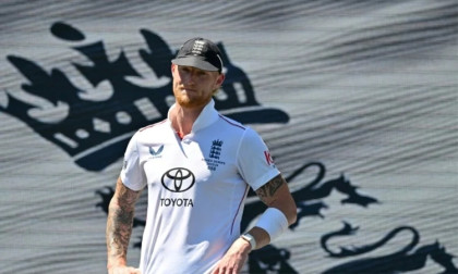 Stokes has surgery after being struck in the face