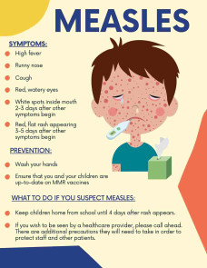 Suspected measles deaths rise to 113, confirmed fatalities reach 17